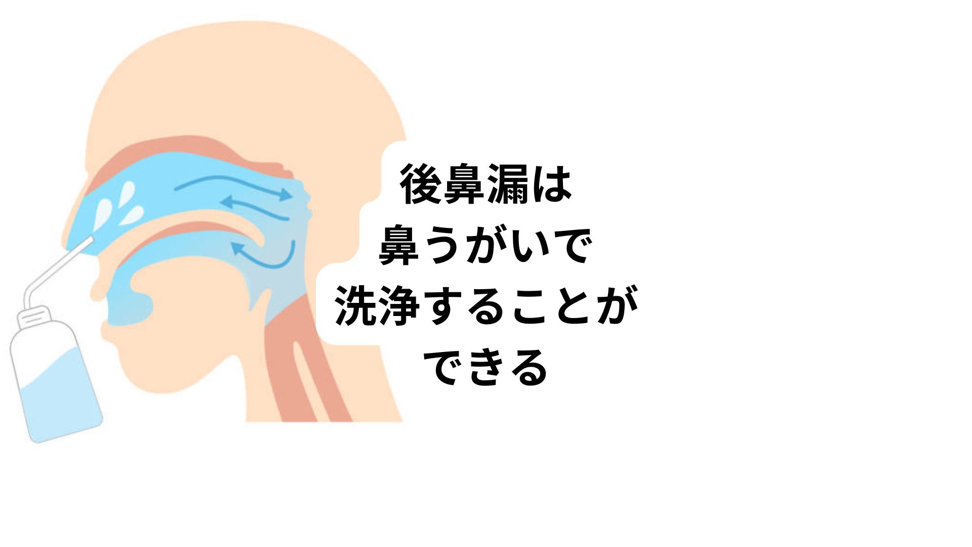 5ちゃんねる 後鼻漏 – 上咽頭炎を治すツボはこの二つだ 完骨と翳風 – GWBPMU